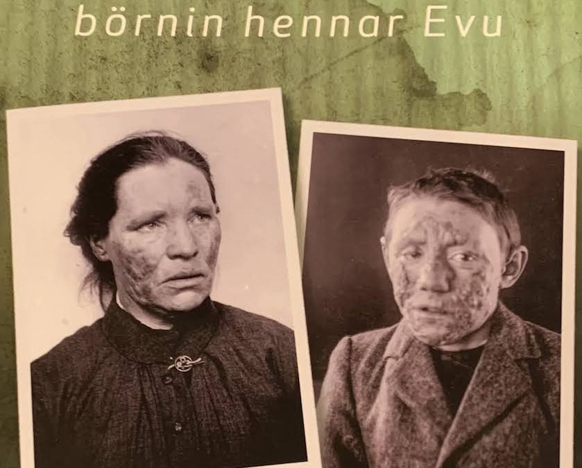 Óhreinu börnin hennar Evu: Holdsveiki í Noregi og á Íslandi